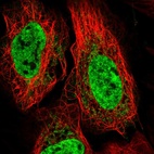 Immunofluorescent staining of human cell line U-2 OS shows localization to nucleoplasm & vesicles.