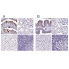 Immunohistochemical staining of human fallopian tube, kidney, liver and lymph node using Anti-CAPSL antibody HPA058495 (A) shows similar protein distribution across tissues to independent antibody HPA046811 (B).