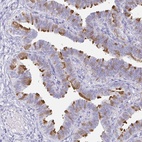 Immunohistochemical staining of human fallopian tube shows high expression.