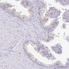 Immunohistochemical staining of human prostate shows low expression as expected.