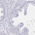 Immunohistochemical staining of human prostate shows low expression as expected.