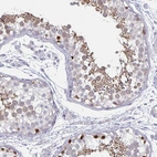 Immunohistochemical staining of human testis shows high expression.