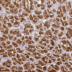 Anti-CMPK1 Antibody