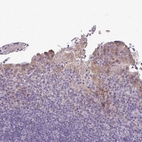 Immunohistochemical staining of human tonsil shows weak nuclear and cytoplasmic positivity in squamous epithelial cells.