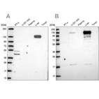 Western blot analysis using Anti-PC antibody HPA058765 (A) shows similar pattern to independent antibody HPA043922 (B).