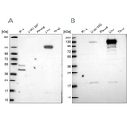 Western blot analysis using Anti-PC antibody HPA058765 (A) shows similar pattern to independent antibody HPA043922 (B).