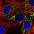 Immunofluorescent staining of human cell line MCF7 shows localization to mitochondria.