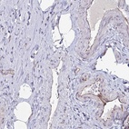 Anti-OR1L3 Antibody