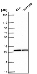 Anti-OVCA2 Antibody