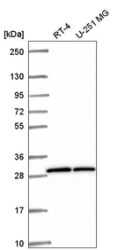 Anti-OVCA2 Antibody