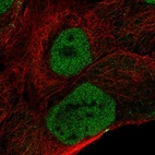 Immunofluorescent staining of human cell line A-431 shows localization to nucleoplasm.