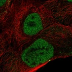 Immunofluorescent staining of human cell line A-431 shows localization to nucleoplasm.