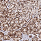 Anti-TMEM41A Antibody