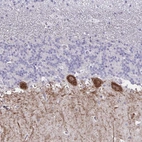 Anti-GALNT16 Antibody