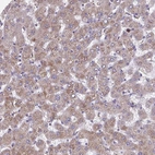 Anti-NIPSNAP1 Antibody