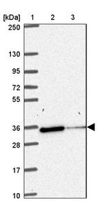 Lane 1: Marker [kDa] 250, 130, 95, 72, 55, 36, 28, 17, 10_br/_Lane 2: Human cell line RT-4_br/_Lane 3: Human cell line U-251MG sp