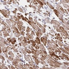 Anti-SKA2 Antibody