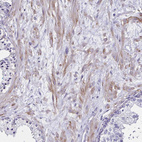 Anti-ITGB1 Antibody