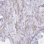 Immunohistochemical staining of human prostate shows moderate cytoplasmic positivity in smooth muscle cells.