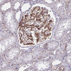Immunohistochemical staining of human kidney shows moderate cytoplasmic/ membranous positivity in cells in glomeruli.