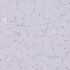 Immunohistochemical staining of human skeletal muscle shows no positivity in myocytes as expected.