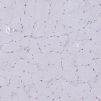 Immunohistochemical staining of human skeletal muscle shows no positivity in myocytes as expected.