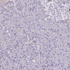 Anti-ITGB1 Antibody