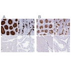 Immunohistochemical staining of human colon, gastrointestinal, skeletal muscle and testis using Anti-CLCA1 antibody HPA059301 (A) shows similar protein distribution across tissues to independent antibody HPA052787 (B).