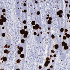 Immunohistochemical staining of human duodenum shows strong cytoplasmic positivity in goblet cells.