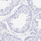 Immunohistochemical staining of human testis shows no positivity in cells in seminiferous ducts as expected.