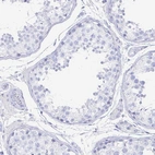 Immunohistochemical staining of human testis shows no positivity in cells in seminiferous ducts as expected.