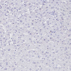 Anti-CLCA1 Antibody