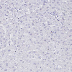 Immunohistochemical staining of human liver shows no positivity in hepatocytes as expected.