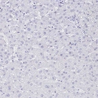 Immunohistochemical staining of human liver shows no positivity in hepatocytes as expected.
