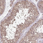 Anti-ZNF200 Antibody
