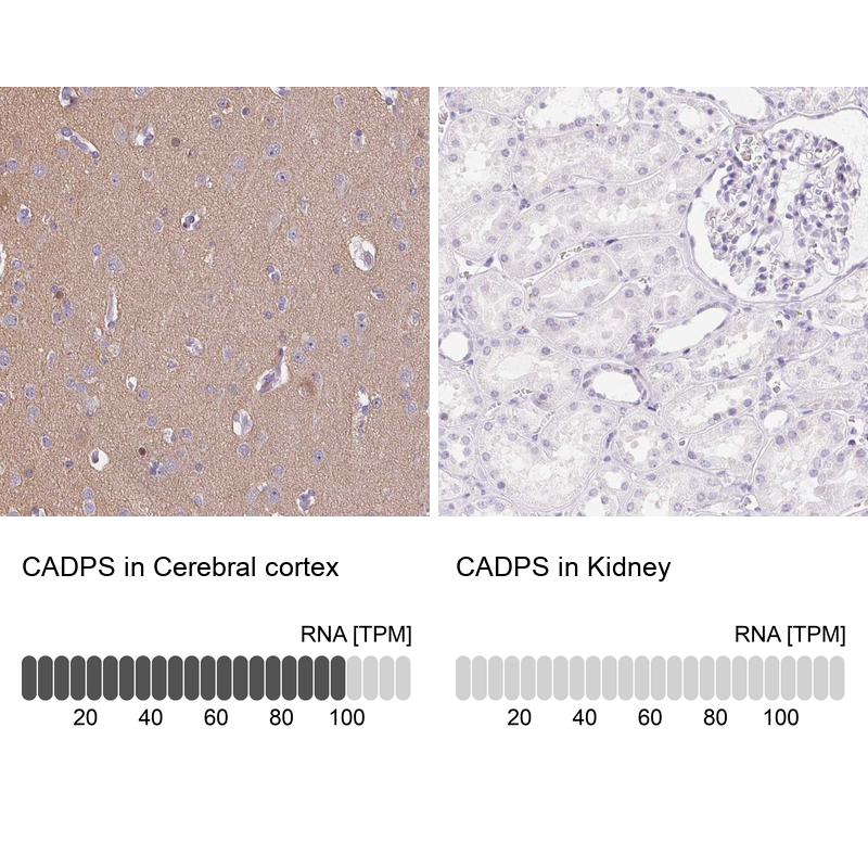Anti-CADPS Antibody