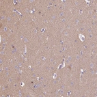 Immunohistochemical staining of human cerebral cortex shows high expression.
