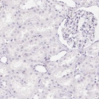 Immunohistochemical staining of human kidney shows low expression as expected.