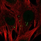 Immunofluorescent staining of human cell line SK-MEL-30 shows localization to vesicles.
