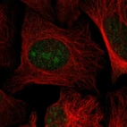 Immunofluorescent staining of human cell line U-2 OS shows localization to nucleus & nucleoli.