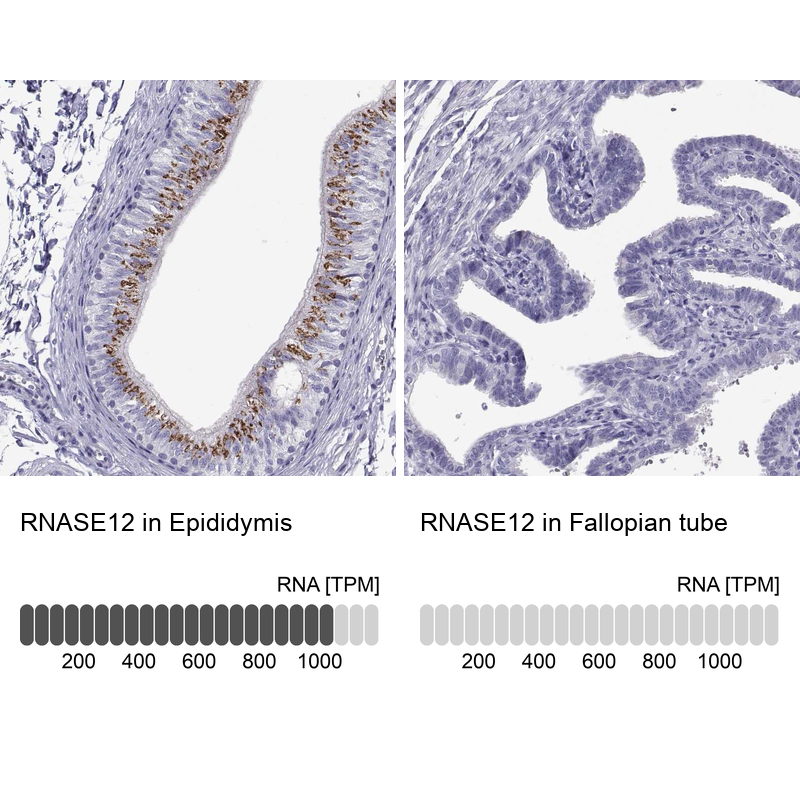 Anti-RNASE12 Antibody
