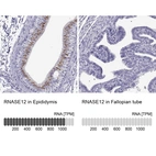 Anti-RNASE12 Antibody