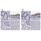 Immunohistochemical staining of human colon, epididymis, kidney and liver using Anti-RNASE12 antibody HPA059465 (A) shows similar protein distribution across tissues to independent antibody HPA044175 (B).