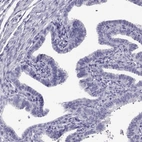 Immunohistochemical staining of human fallopian tube shows low expression as expected.
