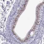 Immunohistochemical staining of human epididymis shows high expression.