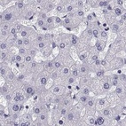 Immunohistochemical staining of human liver using Anti-RNASE12 antibody HPA059465.