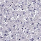 Immunohistochemical staining of human liver using Anti-RNASE12 antibody HPA059465.