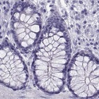 Immunohistochemical staining of human colon using Anti-RNASE12 antibody HPA059465.