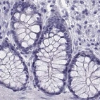 Immunohistochemical staining of human colon using Anti-RNASE12 antibody HPA059465.