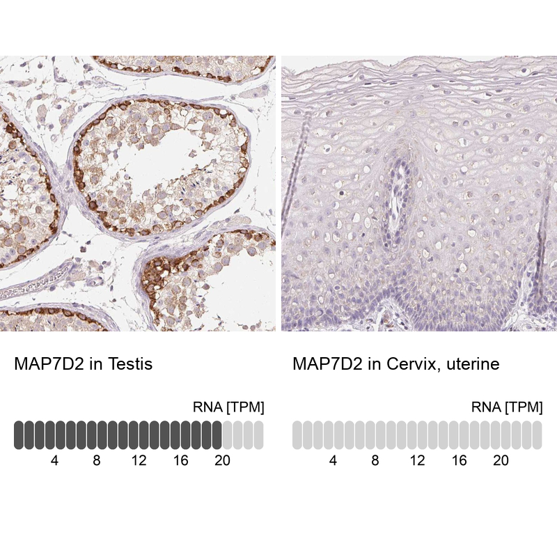 Anti-MAP7D2 Antibody